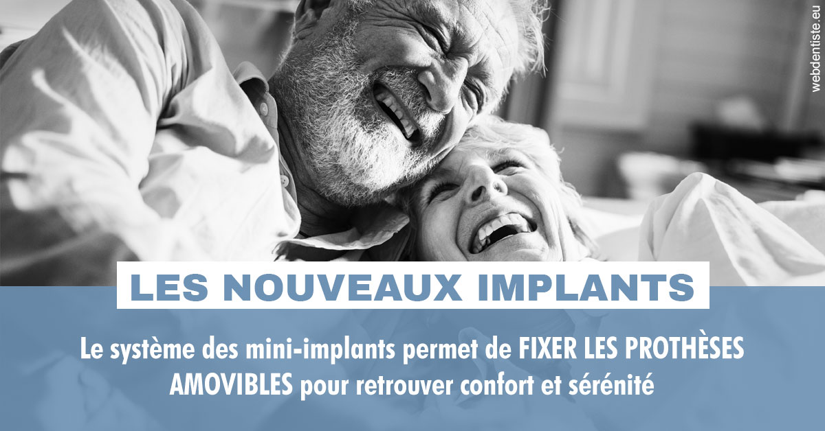 https://scp-peponnet-et-associes.chirurgiens-dentistes.fr/Les nouveaux implants 2