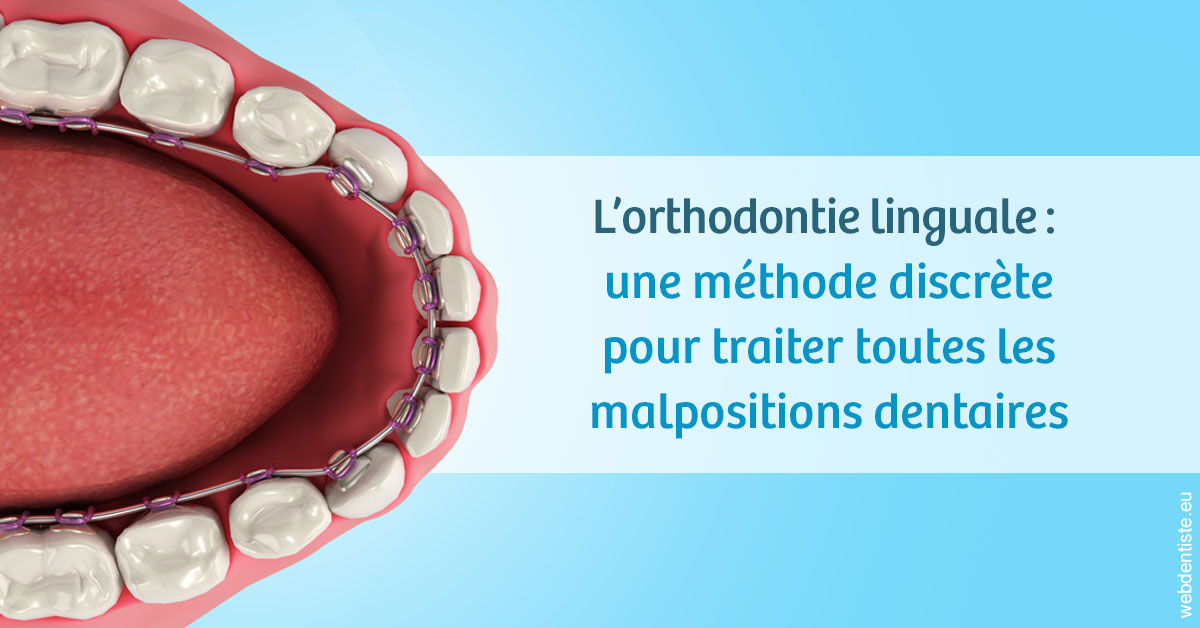 https://scp-peponnet-et-associes.chirurgiens-dentistes.fr/L'orthodontie linguale 1