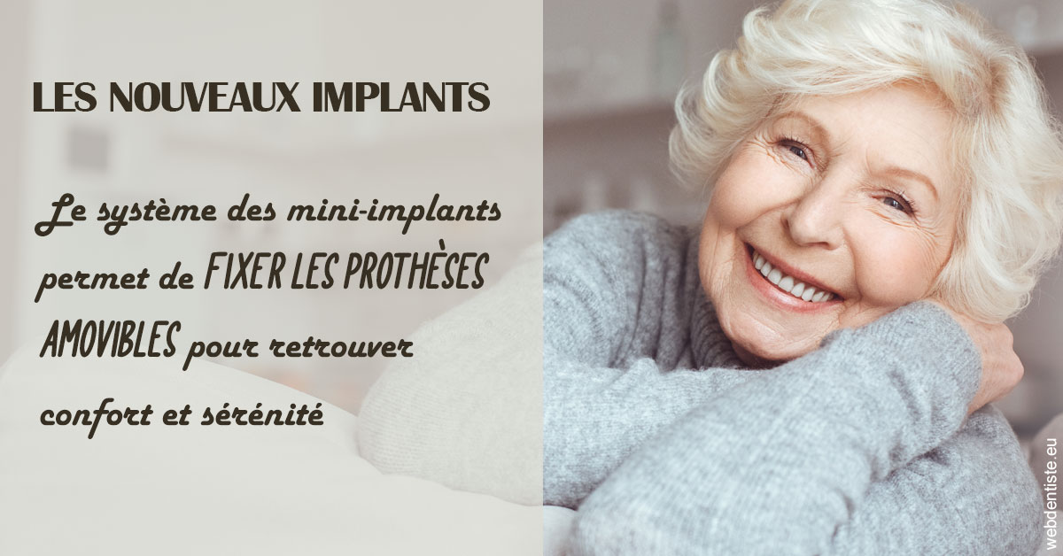 https://scp-peponnet-et-associes.chirurgiens-dentistes.fr/Les nouveaux implants 1