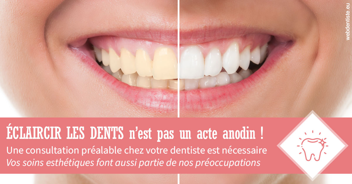 https://scp-peponnet-et-associes.chirurgiens-dentistes.fr/Eclaircir les dents 1