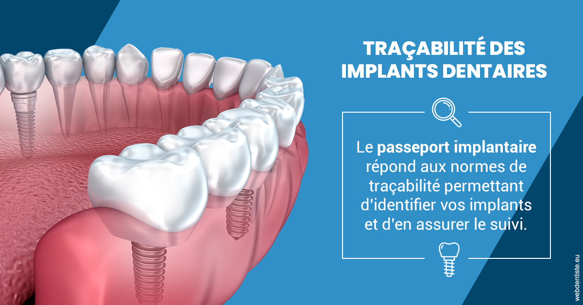 https://scp-peponnet-et-associes.chirurgiens-dentistes.fr/T2 2023 - Traçabilité des implants 1
