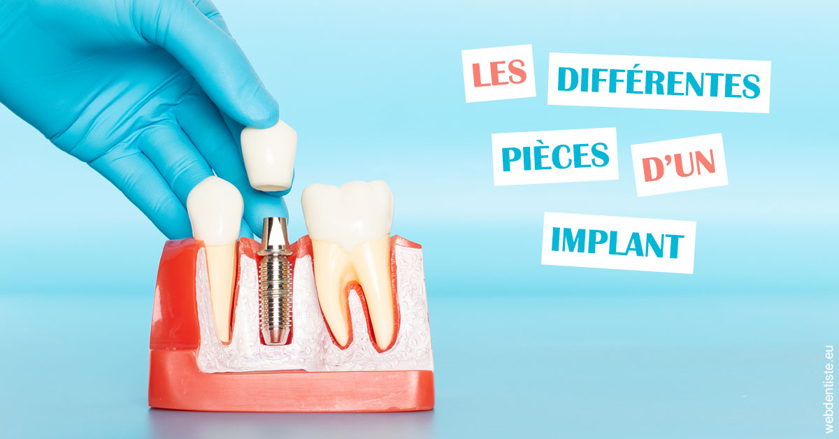 https://scp-peponnet-et-associes.chirurgiens-dentistes.fr/Les différentes pièces d’un implant 2