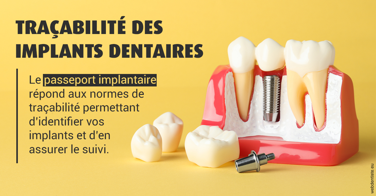 https://scp-peponnet-et-associes.chirurgiens-dentistes.fr/T2 2023 - Traçabilité des implants 2