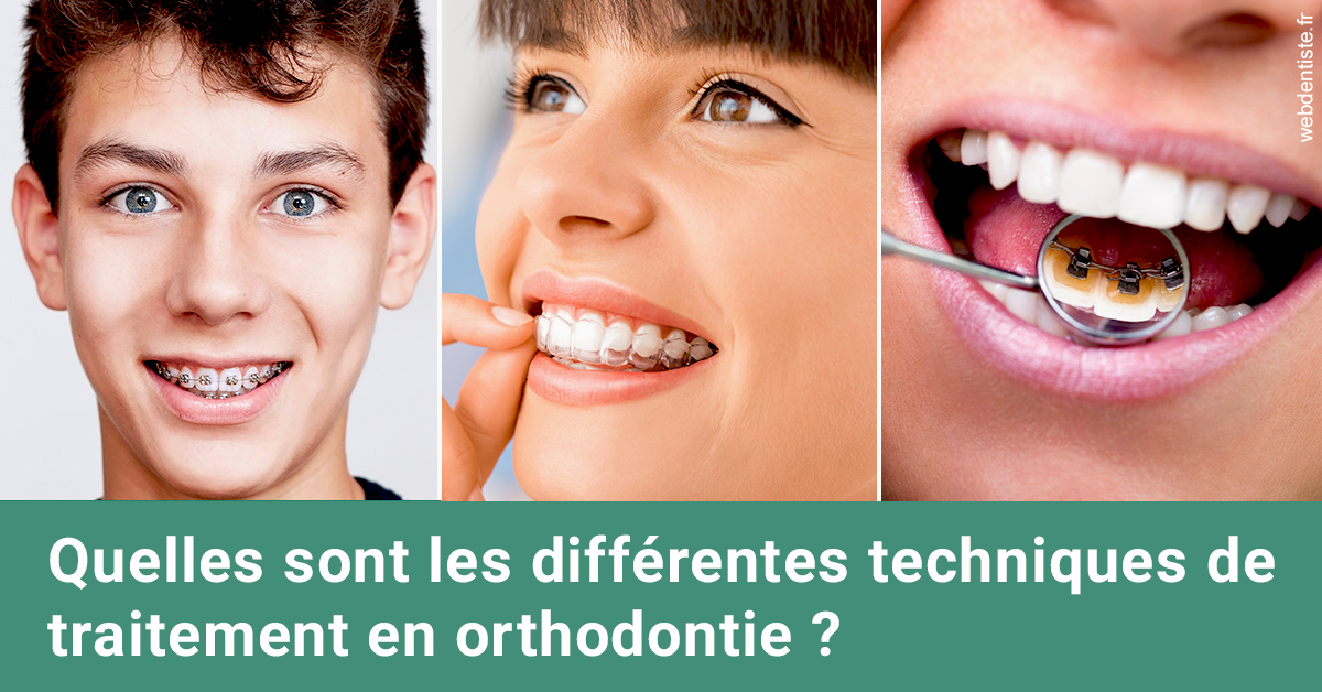 https://scp-peponnet-et-associes.chirurgiens-dentistes.fr/Les différentes techniques de traitement 2