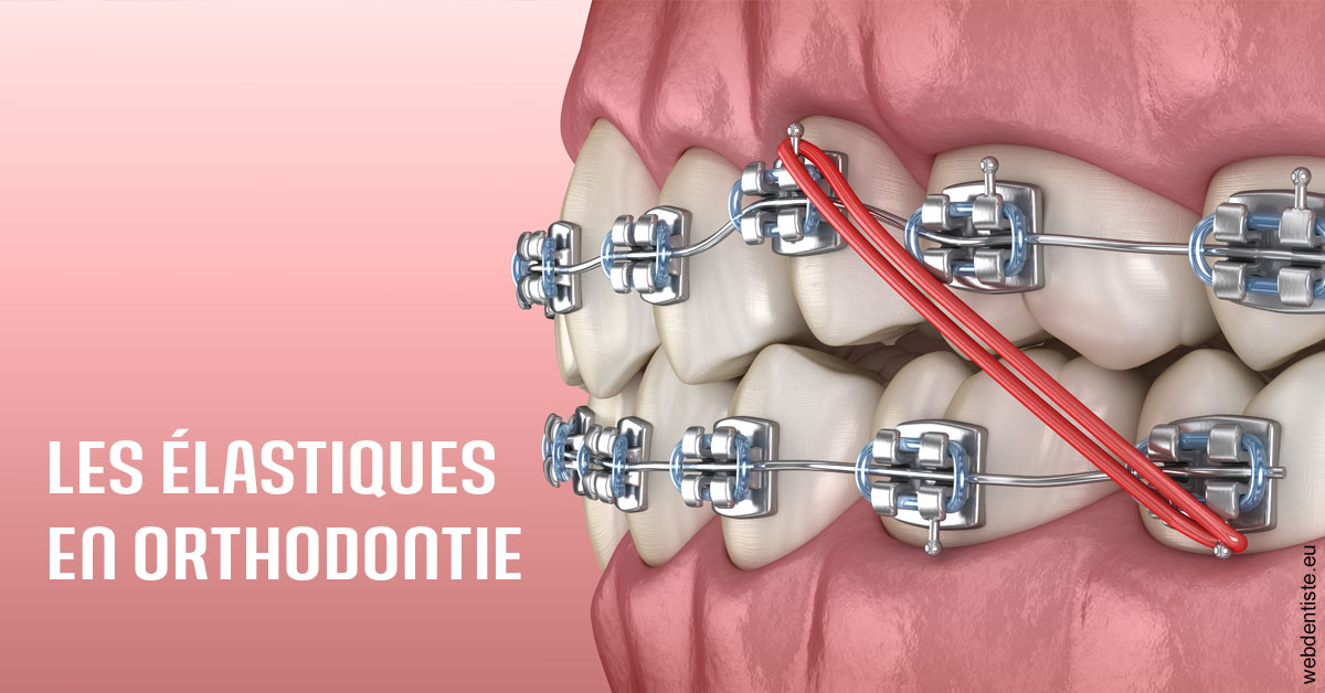 https://scp-peponnet-et-associes.chirurgiens-dentistes.fr/Elastiques orthodontie 2