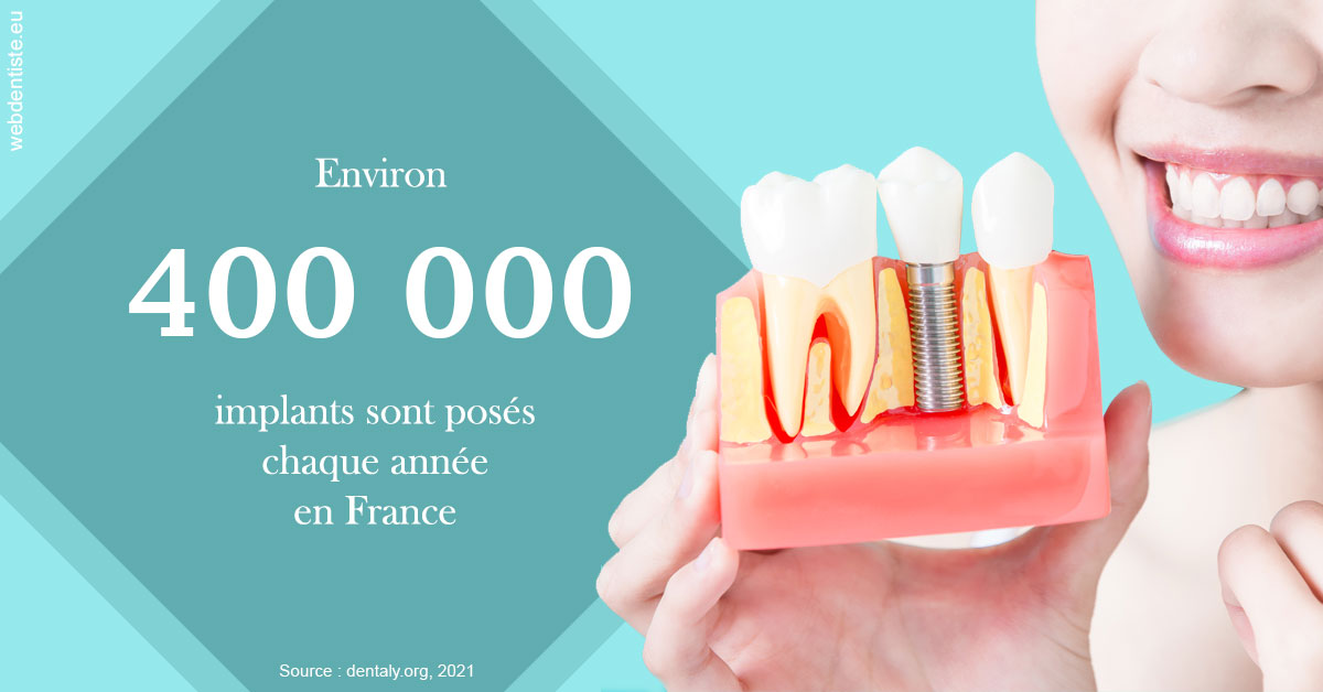 https://scp-peponnet-et-associes.chirurgiens-dentistes.fr/Pose d'implants en France 2